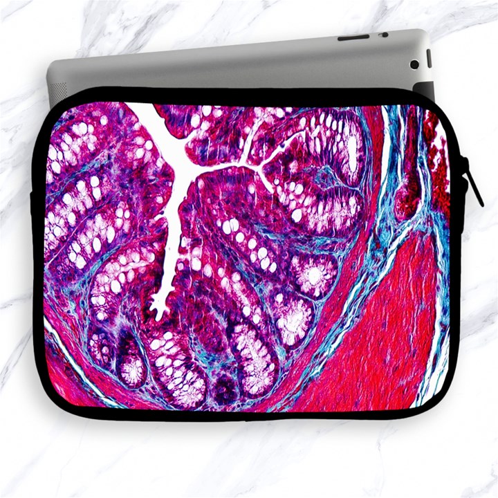 Histology Inc Histo Logistics Incorporated Masson s Trichrome Three Colour Staining Apple iPad 2/3/4 Zipper Cases