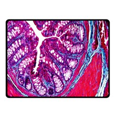 Histology Inc Histo Logistics Incorporated Masson s Trichrome Three Colour Staining Double Sided Fleece Blanket (small)  by Mariart