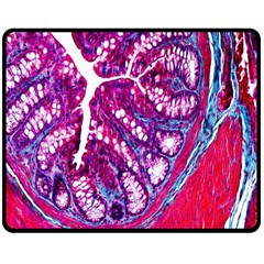 Histology Inc Histo Logistics Incorporated Masson s Trichrome Three Colour Staining Double Sided Fleece Blanket (medium)  by Mariart