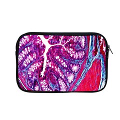 Histology Inc Histo Logistics Incorporated Masson s Trichrome Three Colour Staining Apple Macbook Pro 13  Zipper Case by Mariart