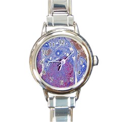 Histology Inc Histo Logistics Incorporated Human Liver Rhodanine Stain Copper Round Italian Charm Watch by Mariart