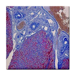 Histology Inc Histo Logistics Incorporated Human Liver Rhodanine Stain Copper Tile Coasters by Mariart