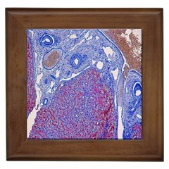 Histology Inc Histo Logistics Incorporated Human Liver Rhodanine Stain Copper Framed Tiles by Mariart