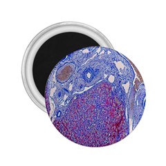 Histology Inc Histo Logistics Incorporated Human Liver Rhodanine Stain Copper 2 25  Magnets by Mariart