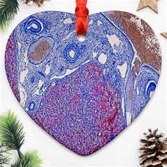 Histology Inc Histo Logistics Incorporated Human Liver Rhodanine Stain Copper Ornament (heart) by Mariart