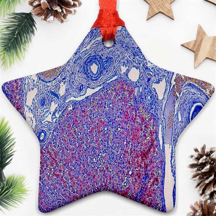 Histology Inc Histo Logistics Incorporated Human Liver Rhodanine Stain Copper Ornament (Star)