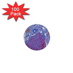 Histology Inc Histo Logistics Incorporated Human Liver Rhodanine Stain Copper 1  Mini Buttons (100 Pack)  by Mariart