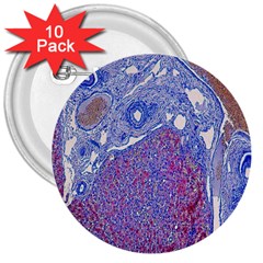 Histology Inc Histo Logistics Incorporated Human Liver Rhodanine Stain Copper 3  Buttons (10 Pack)  by Mariart