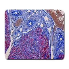 Histology Inc Histo Logistics Incorporated Human Liver Rhodanine Stain Copper Large Mousepads by Mariart