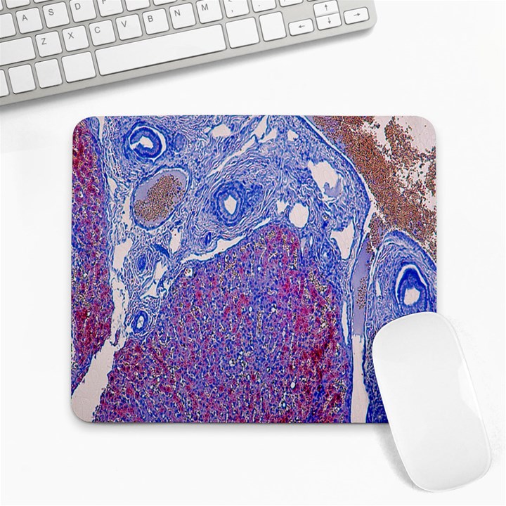 Histology Inc Histo Logistics Incorporated Human Liver Rhodanine Stain Copper Large Mousepads