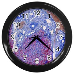 Histology Inc Histo Logistics Incorporated Human Liver Rhodanine Stain Copper Wall Clocks (black) by Mariart