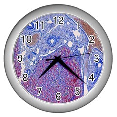 Histology Inc Histo Logistics Incorporated Human Liver Rhodanine Stain Copper Wall Clocks (silver) 