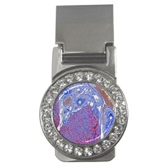 Histology Inc Histo Logistics Incorporated Human Liver Rhodanine Stain Copper Money Clips (cz) 