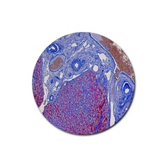 Histology Inc Histo Logistics Incorporated Human Liver Rhodanine Stain Copper Rubber Coaster (round)  by Mariart