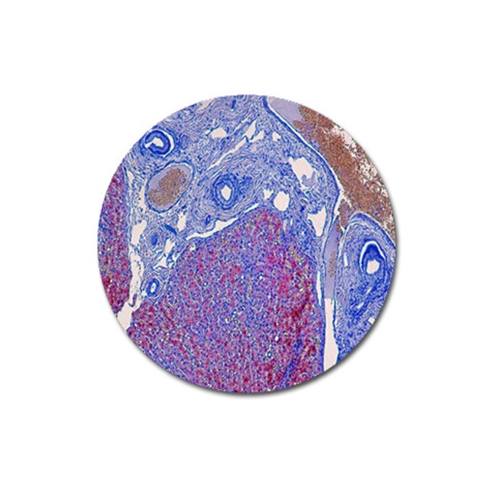 Histology Inc Histo Logistics Incorporated Human Liver Rhodanine Stain Copper Magnet 3  (Round)