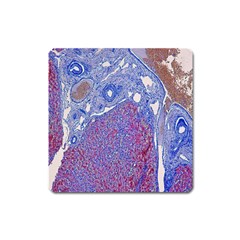 Histology Inc Histo Logistics Incorporated Human Liver Rhodanine Stain Copper Square Magnet by Mariart