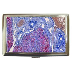 Histology Inc Histo Logistics Incorporated Human Liver Rhodanine Stain Copper Cigarette Money Cases by Mariart