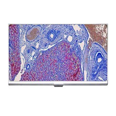 Histology Inc Histo Logistics Incorporated Human Liver Rhodanine Stain Copper Business Card Holders by Mariart