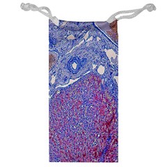 Histology Inc Histo Logistics Incorporated Human Liver Rhodanine Stain Copper Jewelry Bag