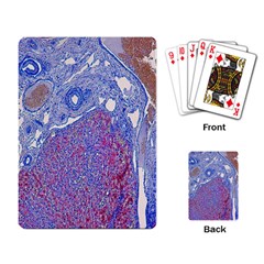 Histology Inc Histo Logistics Incorporated Human Liver Rhodanine Stain Copper Playing Card by Mariart