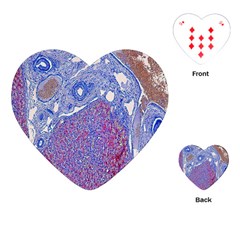 Histology Inc Histo Logistics Incorporated Human Liver Rhodanine Stain Copper Playing Cards (heart) 