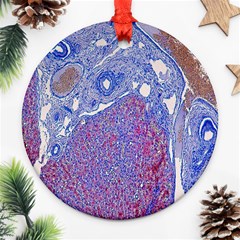 Histology Inc Histo Logistics Incorporated Human Liver Rhodanine Stain Copper Round Ornament (two Sides) by Mariart