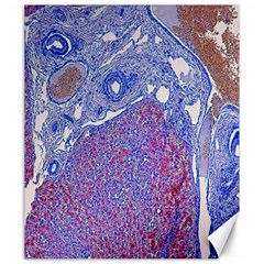 Histology Inc Histo Logistics Incorporated Human Liver Rhodanine Stain Copper Canvas 20  X 24   by Mariart