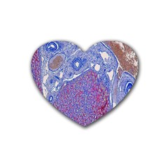 Histology Inc Histo Logistics Incorporated Human Liver Rhodanine Stain Copper Rubber Coaster (heart)  by Mariart