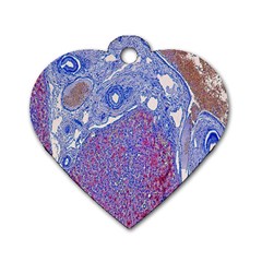 Histology Inc Histo Logistics Incorporated Human Liver Rhodanine Stain Copper Dog Tag Heart (one Side) by Mariart