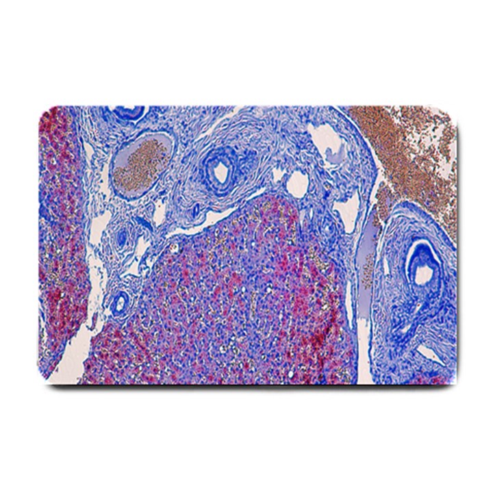 Histology Inc Histo Logistics Incorporated Human Liver Rhodanine Stain Copper Small Doormat 