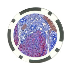 Histology Inc Histo Logistics Incorporated Human Liver Rhodanine Stain Copper Poker Chip Card Guard by Mariart