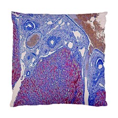 Histology Inc Histo Logistics Incorporated Human Liver Rhodanine Stain Copper Standard Cushion Case (two Sides) by Mariart