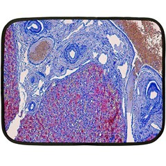 Histology Inc Histo Logistics Incorporated Human Liver Rhodanine Stain Copper Fleece Blanket (mini)