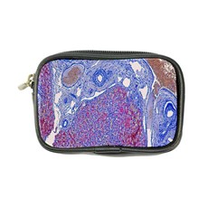 Histology Inc Histo Logistics Incorporated Human Liver Rhodanine Stain Copper Coin Purse by Mariart