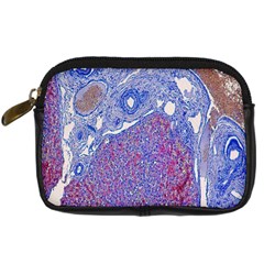 Histology Inc Histo Logistics Incorporated Human Liver Rhodanine Stain Copper Digital Camera Cases by Mariart