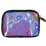 Histology Inc Histo Logistics Incorporated Human Liver Rhodanine Stain Copper Digital Camera Cases Back