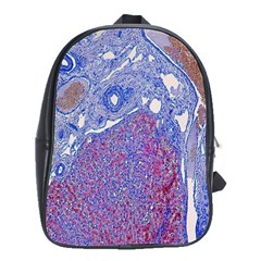 Histology Inc Histo Logistics Incorporated Human Liver Rhodanine Stain Copper School Bag (large)