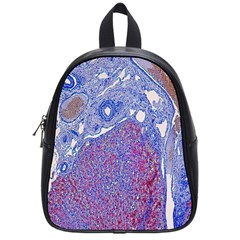 Histology Inc Histo Logistics Incorporated Human Liver Rhodanine Stain Copper School Bag (small) by Mariart