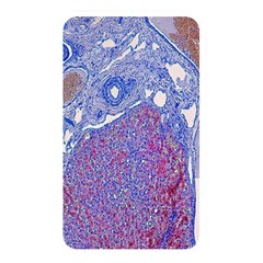 Histology Inc Histo Logistics Incorporated Human Liver Rhodanine Stain Copper Memory Card Reader by Mariart