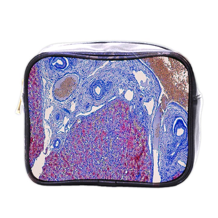 Histology Inc Histo Logistics Incorporated Human Liver Rhodanine Stain Copper Mini Toiletries Bags