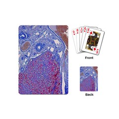 Histology Inc Histo Logistics Incorporated Human Liver Rhodanine Stain Copper Playing Cards (mini)  by Mariart