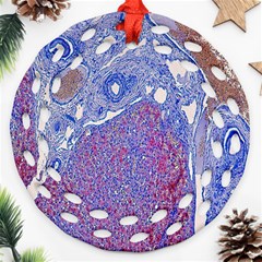 Histology Inc Histo Logistics Incorporated Human Liver Rhodanine Stain Copper Ornament (round Filigree) by Mariart