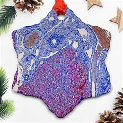 Histology Inc Histo Logistics Incorporated Human Liver Rhodanine Stain Copper Ornament (snowflake) by Mariart