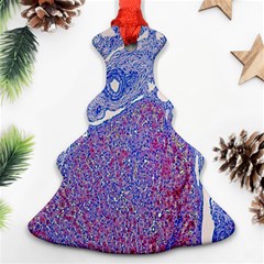 Histology Inc Histo Logistics Incorporated Human Liver Rhodanine Stain Copper Ornament (christmas Tree)  by Mariart