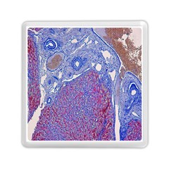 Histology Inc Histo Logistics Incorporated Human Liver Rhodanine Stain Copper Memory Card Reader (square)  by Mariart