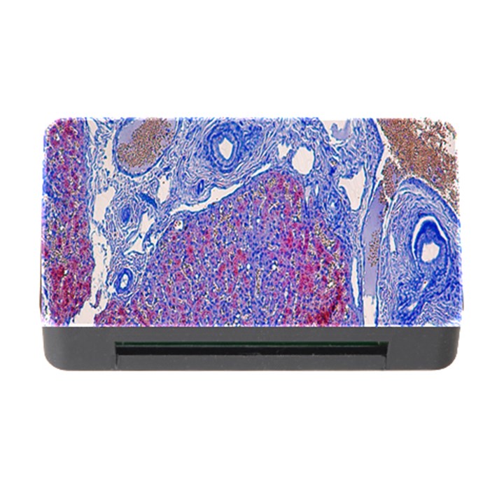 Histology Inc Histo Logistics Incorporated Human Liver Rhodanine Stain Copper Memory Card Reader with CF