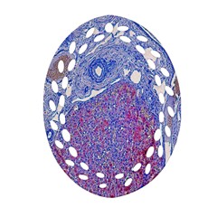 Histology Inc Histo Logistics Incorporated Human Liver Rhodanine Stain Copper Oval Filigree Ornament (two Sides) by Mariart