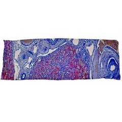 Histology Inc Histo Logistics Incorporated Human Liver Rhodanine Stain Copper Body Pillow Case Dakimakura (two Sides) by Mariart