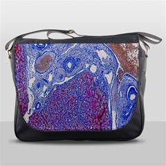 Histology Inc Histo Logistics Incorporated Human Liver Rhodanine Stain Copper Messenger Bags by Mariart