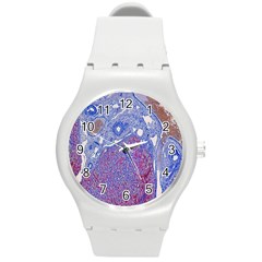 Histology Inc Histo Logistics Incorporated Human Liver Rhodanine Stain Copper Round Plastic Sport Watch (m) by Mariart